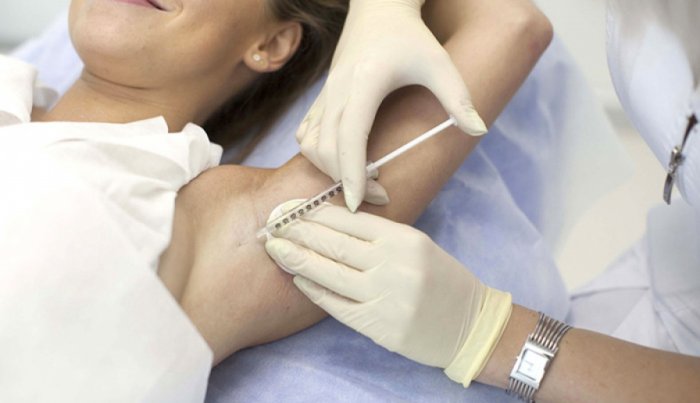 Гипергидроз подмышек 02