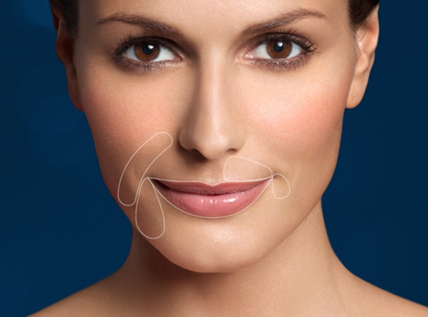 Преимущества подтяжки уголков рта