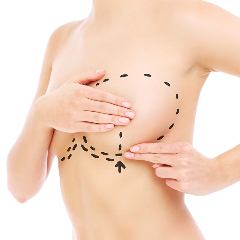 Genesis - лучшая маммопластика во Львове 01