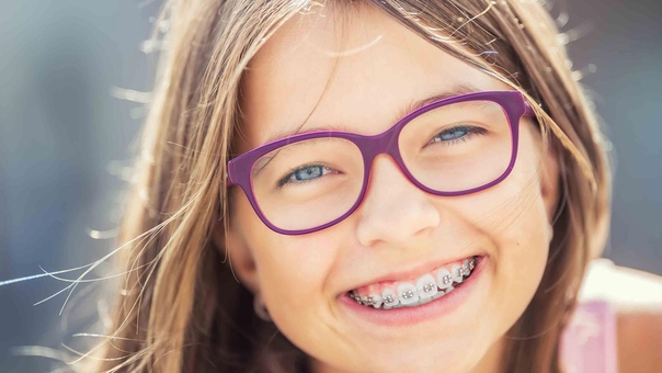 Брекеты – оптимальная техника исправления прикуса