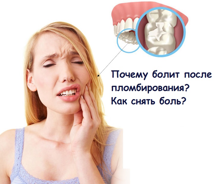 Сильно болит зуб что делать в домашних. Болит зуб. Боль в зубе. Болит зуб после пломбы.