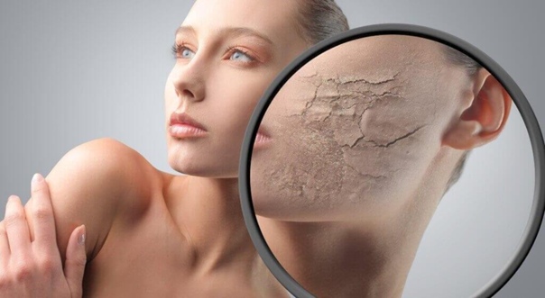 Причины появления псориаза