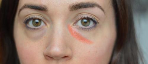 Убрать синяк под глазом зубной пастой. Как использовать зубную пасту?