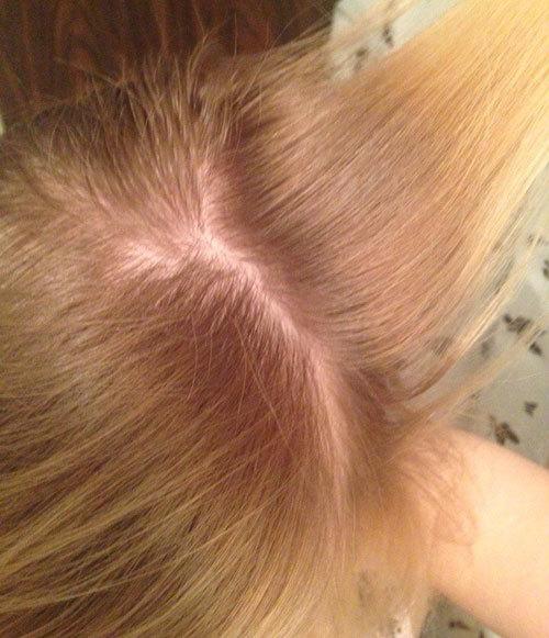 Маска для кожи головы в домашних условиях. Рецепты масок для кожи головы