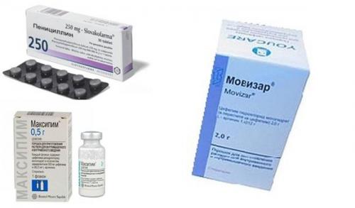 Негормональные препараты от мастопатии. Варианты терапии