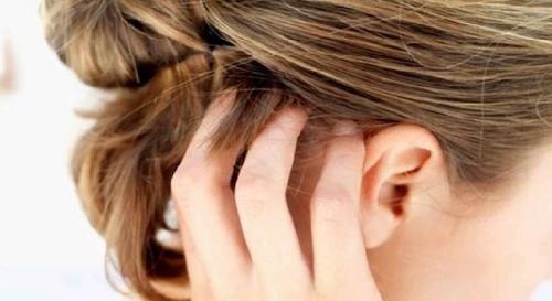 Маска для кожи головы от зуда и шелушения в домашних условиях. Маски от зуда и шелушения кожи на голове 02 Маска для кожи головы от зуда и шелушения в домашних условиях. Маски от зуда и шелушения кожи на голове 02