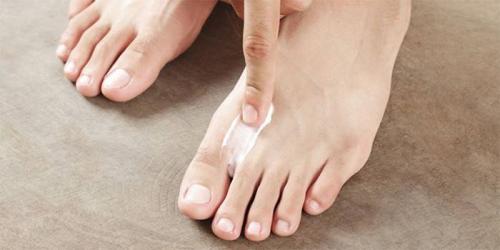 Как избавиться от грибка на ногах в домашних условиях быстро. Препараты