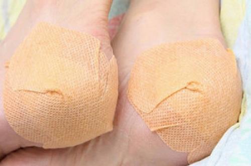 Мази от натоптышей на ступнях. Антимозольные кремы и мази 06