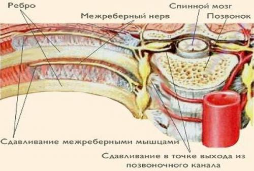 Болит под правой грудью тяжело дышать. Почему болит справа в груди?