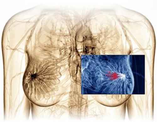 Болит грудь в области соска при нажатии. Боль при надавливании на грудь: причины и тревожные симптомы