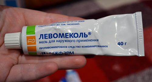 Дешевая мазь от зуда. Антигистаминные мази