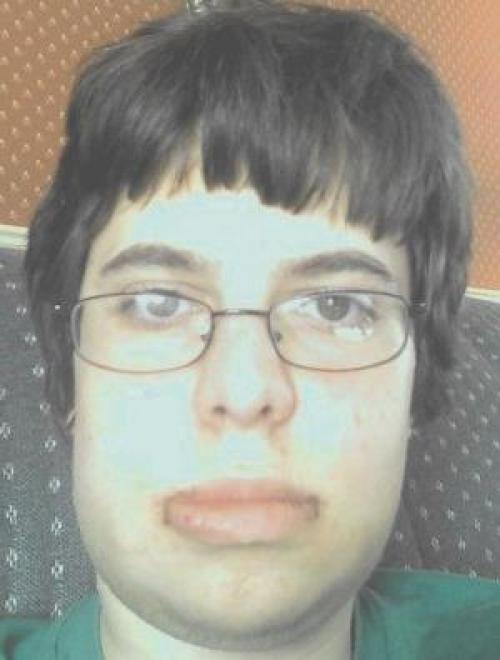 Отек лица причины у женщин. Отек и неправильный образ жизни 01