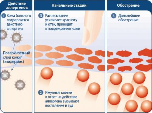 Мазь от расчесов на коже. Мазь от зуда на коже | Школа красоты