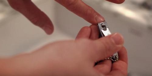 Нарывает палец на руке после пореза. Почему нарывает палец возле ногтя на руках и ногах?