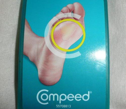 Мазь от натоптышей в аптеке. Медикаментозная терапия