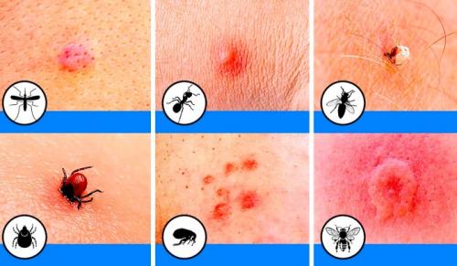 Средство от зуда кожи. Что такое зуд, его признаки