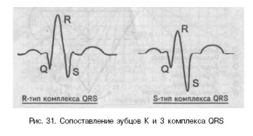 Угол альфа равен углу бета. Угол Альфа QRS на ЭКГ. М образный QRS В 3 стандартном отведении. Расшифровка ЭКГ угол Альфа. Угол Альфа и бета.