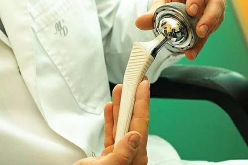 Осложнения после укола в коленный сустав гиалуроновой кислоты. Показания к введению гиалуроновой кислоты в коленный сустав 01 Осложнения после укола в коленный сустав гиалуроновой кислоты. Показания к введению гиалуроновой кислоты в коленный сустав 01