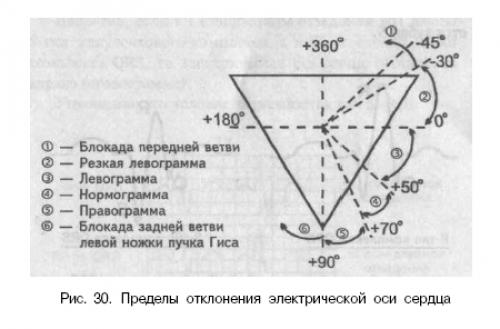 электрическая ось сердца треугольник эйнтховена