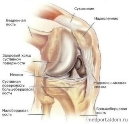 Истончение гиалинового хряща коленного сустава. Характер возникающей проблемы