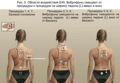 Что такое фонирование суставов в домашних условиях. Почему фонирование универсальное средство лечения? 05 Что такое фонирование суставов в домашних условиях. Почему фонирование универсальное средство лечения? 05