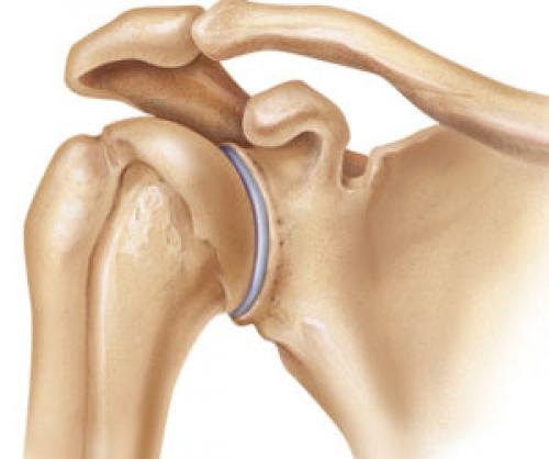 Хрустят плечи при круговых движениях. План действий и лечения 01