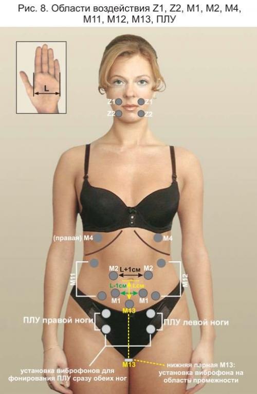 Фонирование википедия. Области воздействия и места установки виброфонов