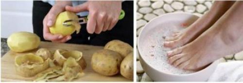 Шишки на ногах лечение народными средствами. Как избавиться от косточки на ногах народными средствами