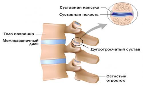Артроз реберно-позвоночных сочленений. Что такое артроз реберно-позвоночных суставов? 02 Артроз реберно-позвоночных сочленений. Что такое артроз реберно-позвоночных суставов? 02