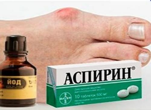 Как убрать косточку на ноге в домашних условиях. Лечение поваренной и морской солью