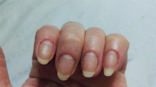 Как ухаживать за ногтями после снятия гель-лака. Главные проблемы ногтей после гель лака