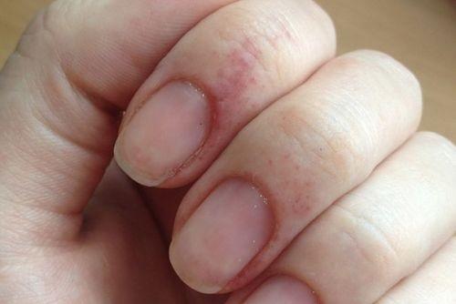 Как ухаживать за ногтями после снятия гель-лака. Главные проблемы ногтей после гель лака