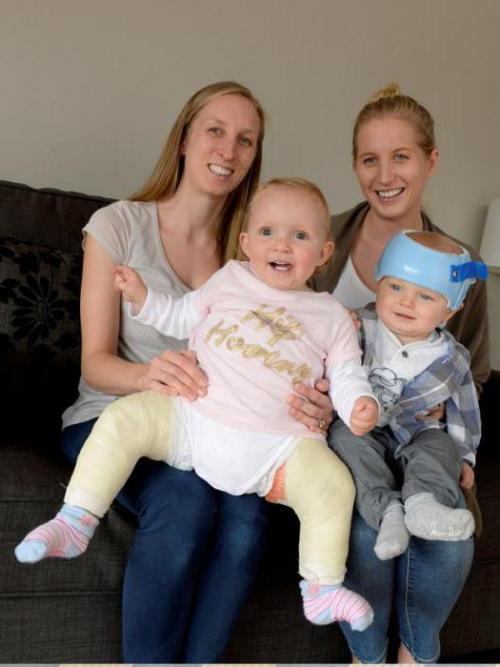 Ортез при дисплазии. Детский отводящий тазобедренный ортез Тюбингер 07 Ортез при дисплазии. Детский отводящий тазобедренный ортез Тюбингер 07