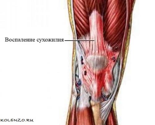 Коленный сустав. Эффективные средства от боли в коленном суставе
