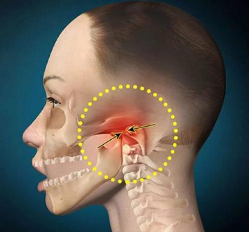 Подвывих челюсти, как вправить самостоятельно. Исправляем вывих челюсти –, как вправить челюсть самостоятельно