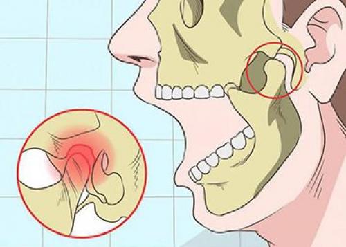 Подвывих челюсти, как вправить самостоятельно. Исправляем вывих челюсти –, как вправить челюсть самостоятельно