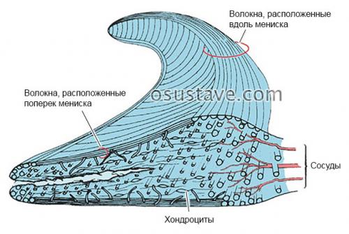 Как лечат мениск в колене. Что такое мениск коленного сустава, возможные повреждения, их причины и лечение