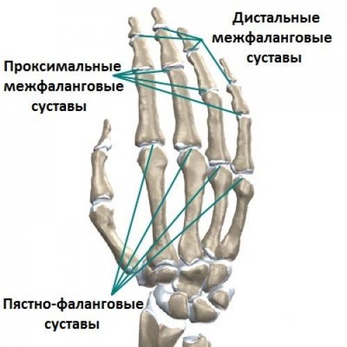 Дистальные межфаланговые суставы кисти фото