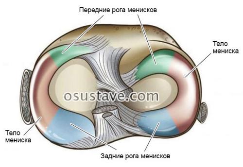 Как лечат мениск в колене. Что такое мениск коленного сустава, возможные повреждения, их причины и лечение