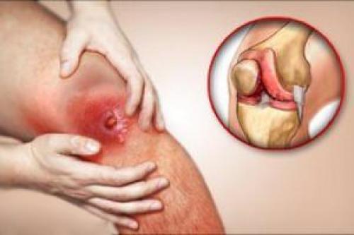 Межфаланговый сустав функции. Межфаланговый сустав