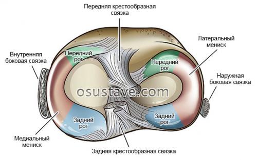 Дегенеративный разрыв мениска коленного сустава симптомы и лечение. Дегенеративные изменения менисков: заднего рога, медиального, 4 степени патологии