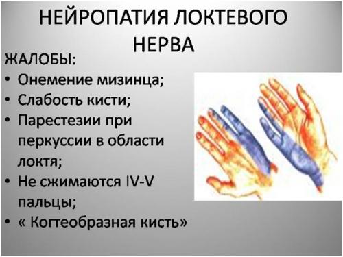 Ударил нерв на локте. Кратко об ушибе локтя и его причинах