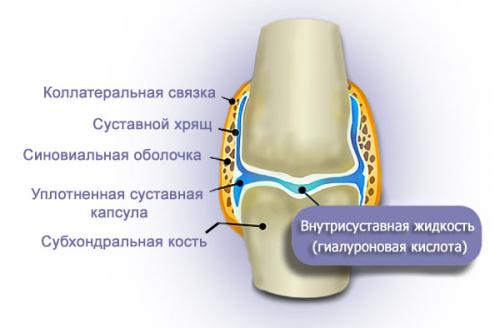 Гиалуроновая кислота для суставов инъекции. Применение препаратов гиалуроновой кислоты для суставов, их эффективность