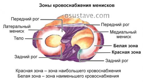 Дегенеративный разрыв мениска коленного сустава симптомы и лечение. Дегенеративные изменения менисков: заднего рога, медиального, 4 степени патологии