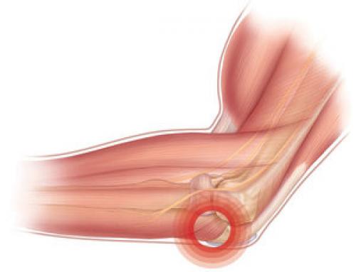 После падения болит локоть. Симптомы ушиба локтевого сустава 01