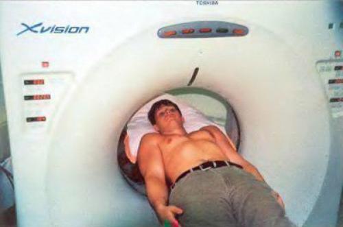 Перелом хилла сакса. Непростой перелом головки плеча испортит не только отпуск 03