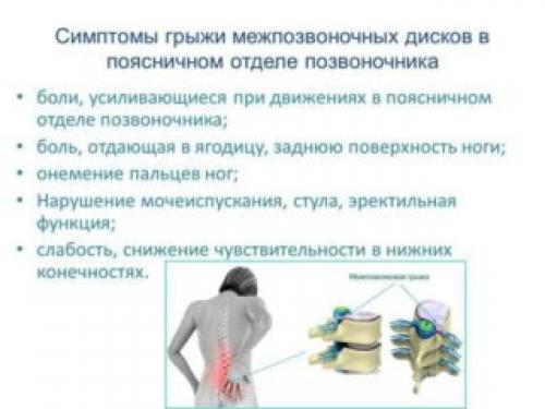Слабость в коленях и боль. Как проявляется слабость в коленях 10 Слабость в коленях и боль. Как проявляется слабость в коленях 10