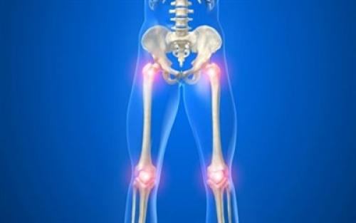 Остеоартроз диета. Лечебная диета при артрозе: 10 полезных продуктов питания!