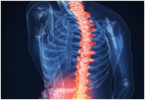 Препараты наращивающие хрящевую ткань. Препараты для восстановления хрящевой ткани суставов: мифы и реальность 08 Препараты наращивающие хрящевую ткань. Препараты для восстановления хрящевой ткани суставов: мифы и реальность 08
