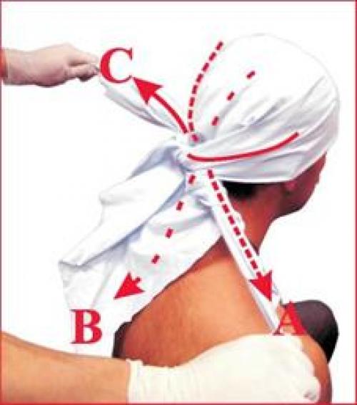 Повязка косыночная. Техника наложения повязок Косыночные повязки